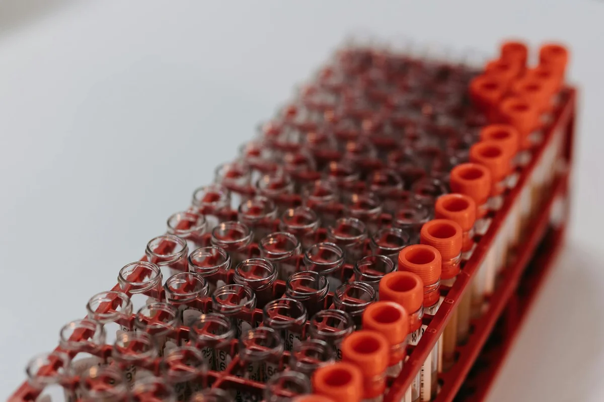 Close-up of a rack of microcentrifuge tubes filled with soil samples in a laboratory setting.